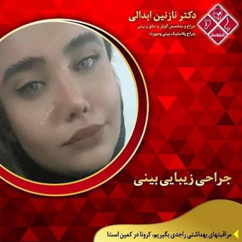 جراحی-بینی-مشهد-249
