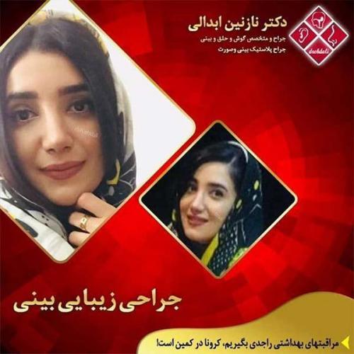 جراحی-بینی-مشهد-252