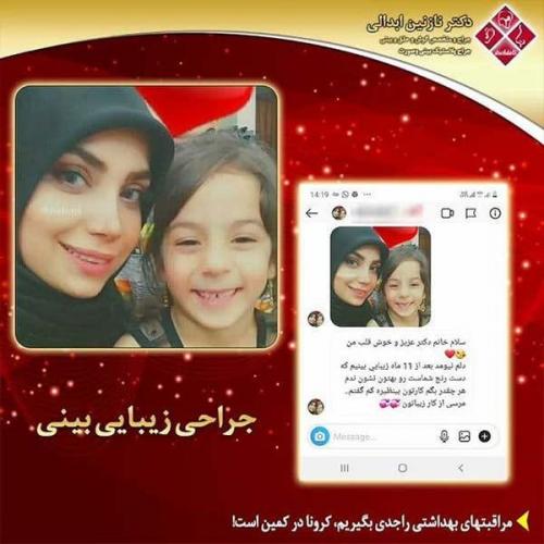 جراحی-بینی-مشهد-258