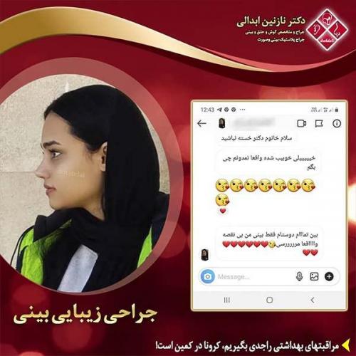 جراحی-بینی-مشهد-264