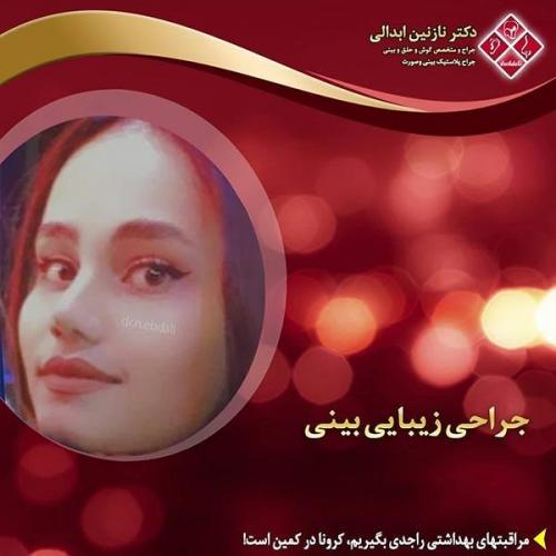 جراحی-بینی-مشهد-265