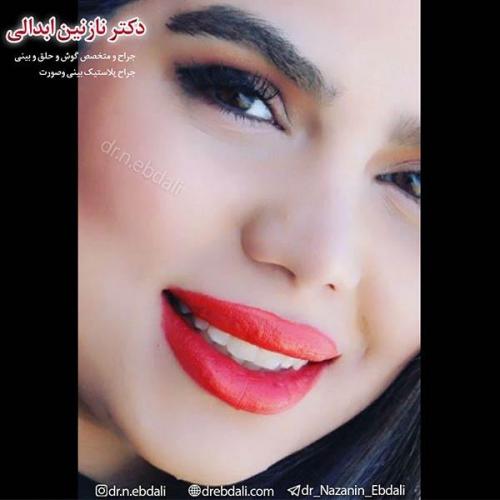 جراحی-بینی-مشهد-46