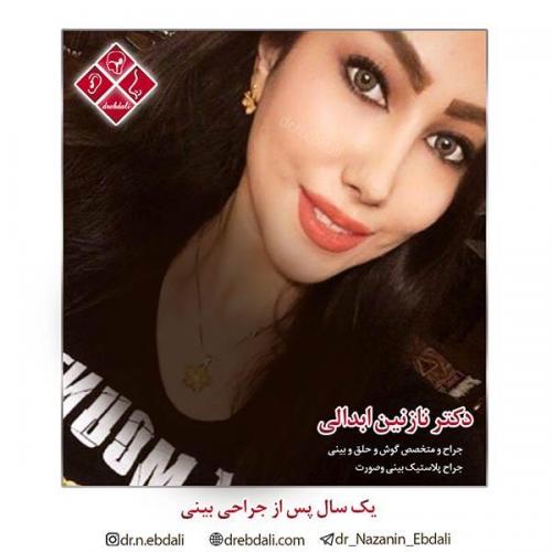 جراحی-بینی-مشهد-55