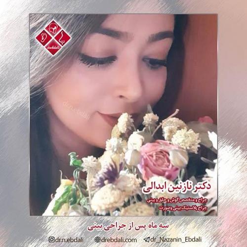 جراحی-بینی-مشهد-56