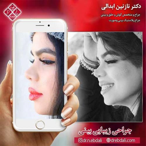 جراحی-بینی-مشهد-67