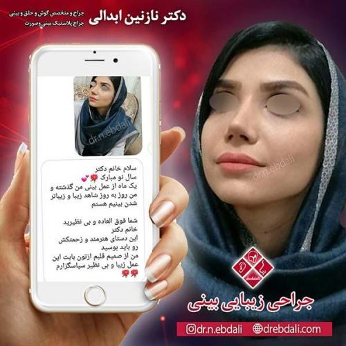 جراحی-بینی-مشهد-69