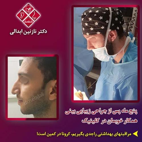 جراحی-بینی-مشهد-89