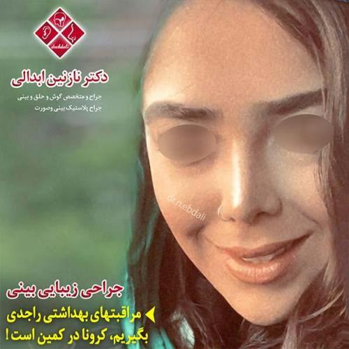 جراحی-بینی-مشهد-96