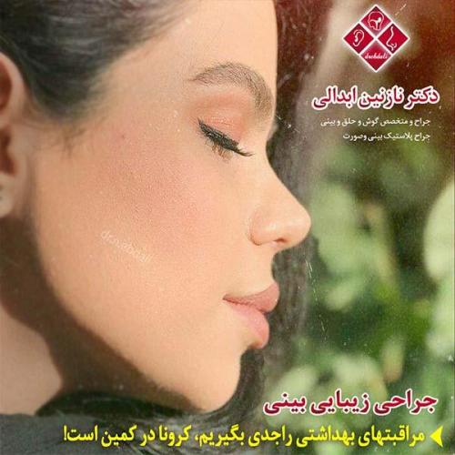 جراحی-بینی-مشهد-99