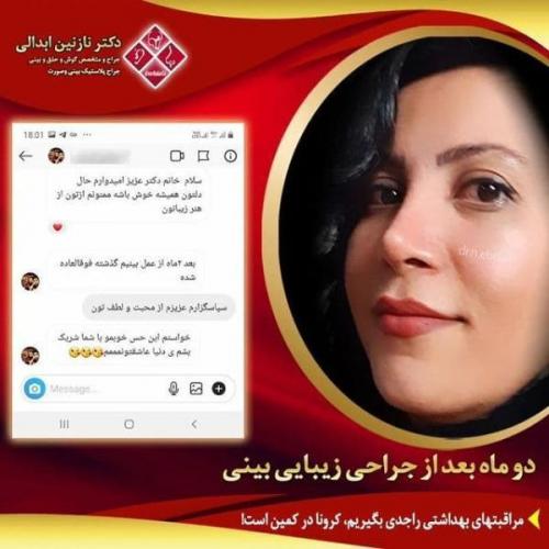 جراحی بینی 269 (1)