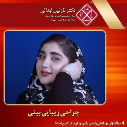 جراحی بینی 269 (19)
