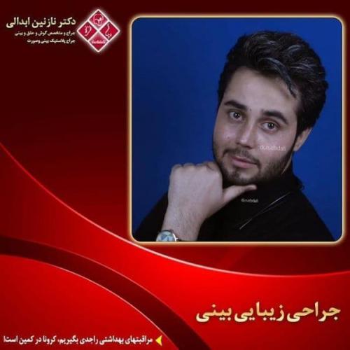 جراحی بینی 269 (22)