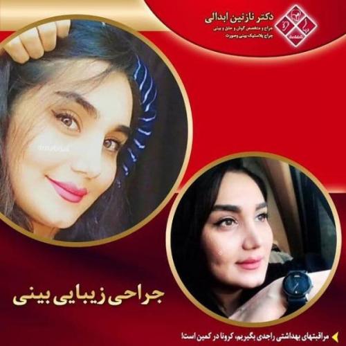 جراحی بینی 269 (27)
