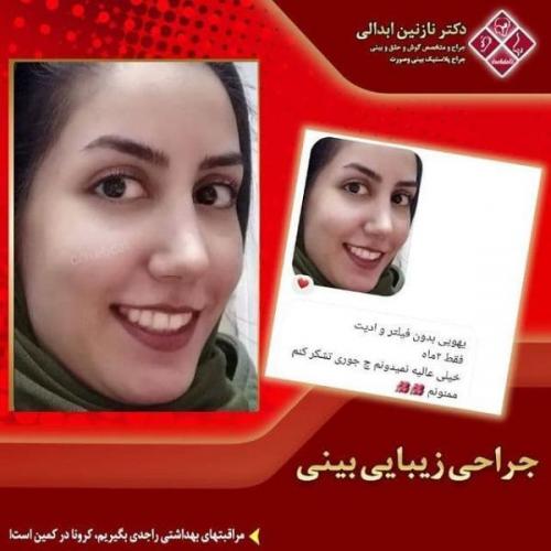 جراحی بینی 269 (31)