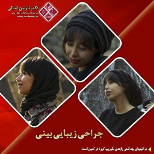 جراحی بینی 269 (34)