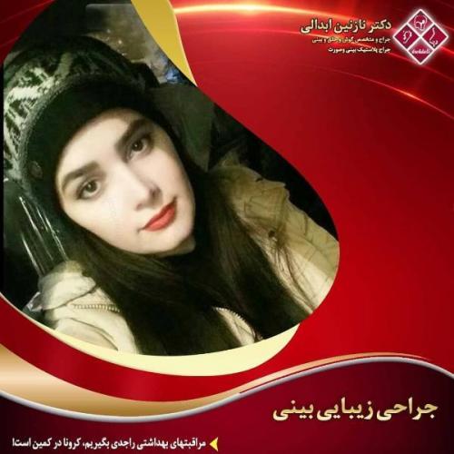 جراحی بینی 269 (36)