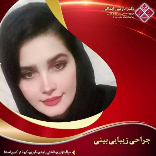 جراحی بینی 269 (37)