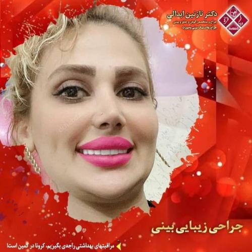 جراحی بینی 269 (40)