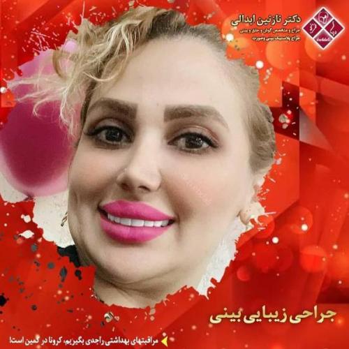 جراحی بینی 269 (41)