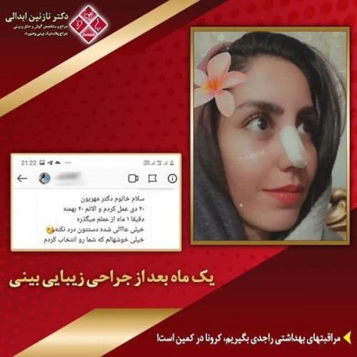 جراحی بینی 269 (7)