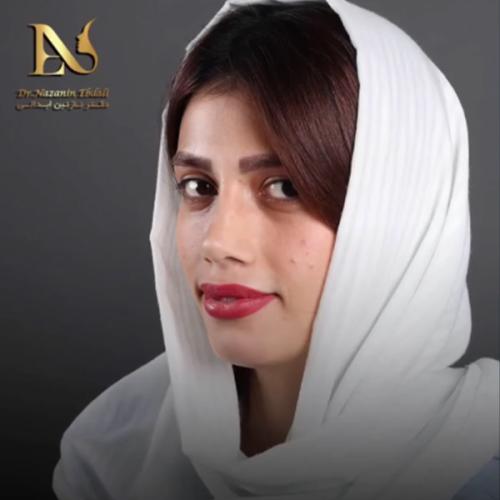 rhinoplasty-777-Copy