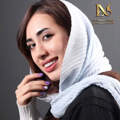 rhinoplasty-780-Copy