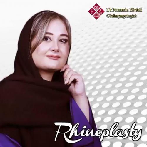 جراحی-بینی-575 (1)