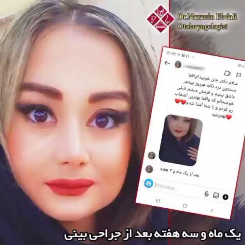 جراحی-بینی-576