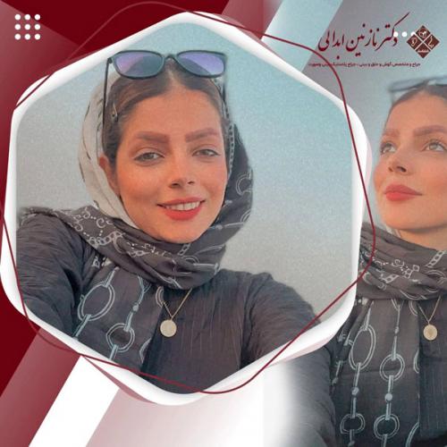 جراحی-بینی-579