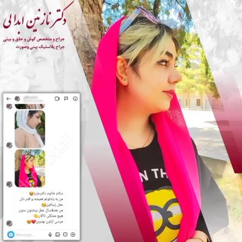 جراحی-بینی-617