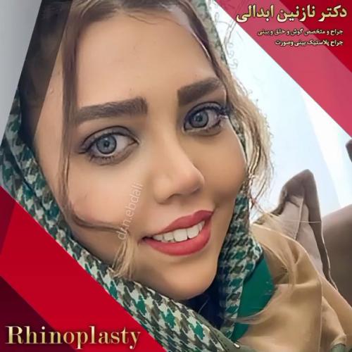 جراحی-بینی-618
