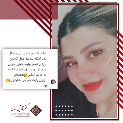 جراحی-بینی-639
