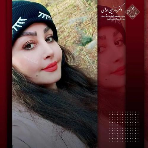 جراحی-بینی-644