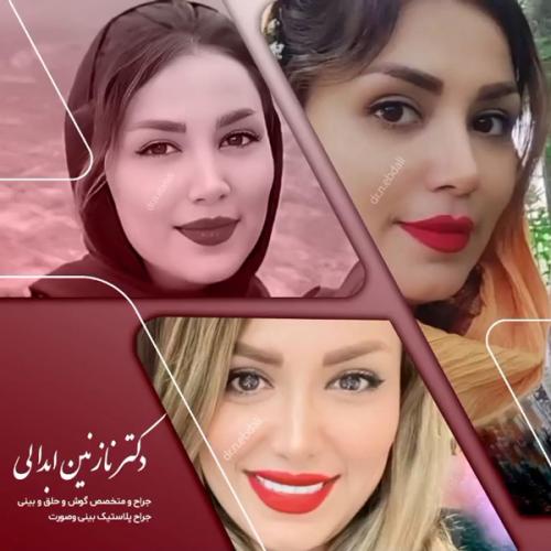 جراحی-بینی624