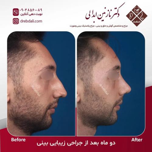 جراحی-بینی648