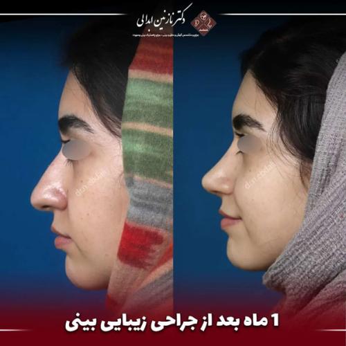 جراحی-بینی669