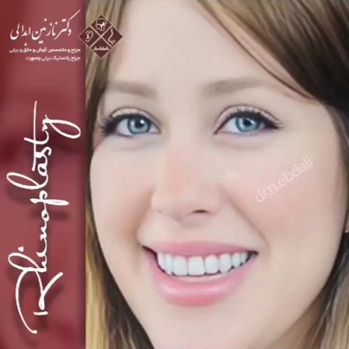 جراحی-بینی675