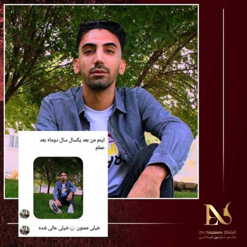 جراحی-بینی692